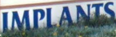 implants